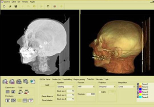 Reconstrucci�n tridimensional de una cabeza